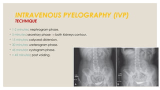 Pyelogram Vs Nephrogram Pmeriksaan Pencitraan Traktus Urinarius. | PPTX