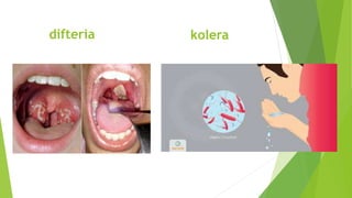 difteria kolera
 