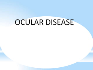 OCULAR DISEASE
 