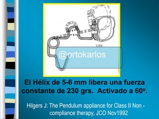 @ortokarlos
El Hélix de 5-6 mm libera una fuerza
constante de 230 grs. Activado a 60o.
Hilgers J: The Pendulum appliance for Class II Non compliance therapy, JCO Nov1992

 