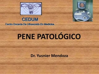 CEDUM
Centro Docente De Ultrasonido En Medicina.

PENE PATOLÓGICO
Dr. Yusnier Mendoza

 