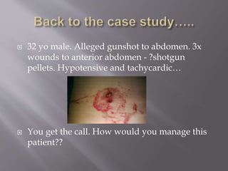  32 yo male. Alleged gunshot to abdomen. 3x
wounds to anterior abdomen - ?shotgun
pellets. Hypotensive and tachycardic…
 You get the call. How would you manage this
patient??
 