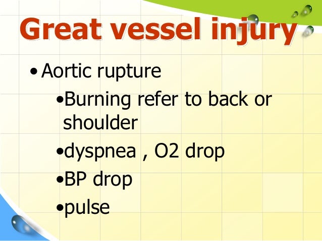 calculate pi injury calculate pi injury