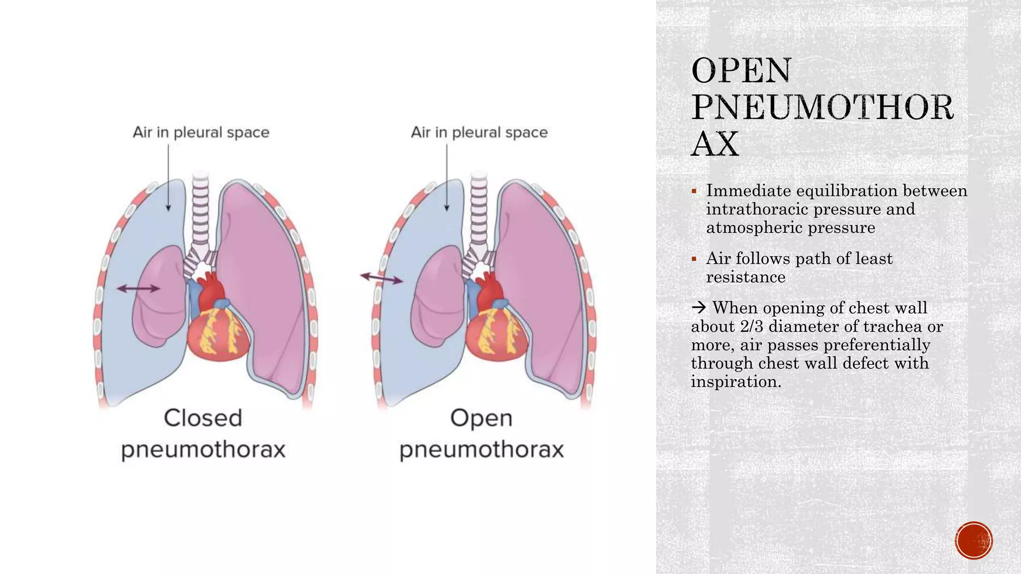 Penetrating chest trauma.pptx