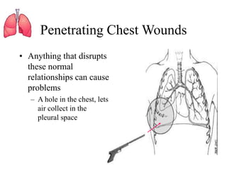 Penetrating chest trauma it's prognosis and management | PPT