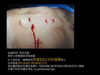 20歲男性周末狂歡 
跟旁人對傳播妹爭風吃醋 
步入急診室，據傳被用長達10公分的扁鑽刺入 
生命徵象BP:130/85 HR:98 BT:37.6 
急診醫師嘗試床邊診視傷口但因為傷口較深而無法得知是否深入腹膜 
且傷口附近持續在滲血, no peritoneal sign 
 