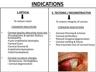 Penetrating Keratoplasty by Pushkar dhir.pptx