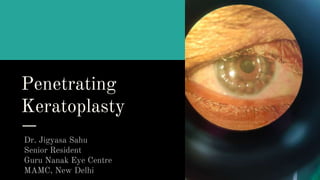 Penetrating
Keratoplasty
Dr. Jigyasa Sahu
Senior Resident
Guru Nanak Eye Centre
MAMC, New Delhi
 