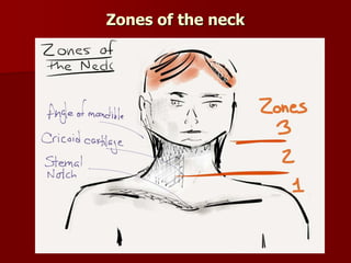 Zones of the neck
 