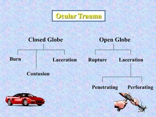  Ocular Trauma Closed GlobeOpen GlobeBurnLacerationLacerationRuptureContusionPenetratingPerforating