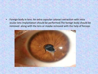 Foreign body in lens: An extra capsular cataract extraction with intra ocular lens implantation should be performed.The foreign body should be removed  along with the lens or maybe removed with the help of forceps