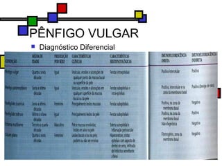 PÊNFIGO VULGAR
 Diagnóstico Diferencial
 