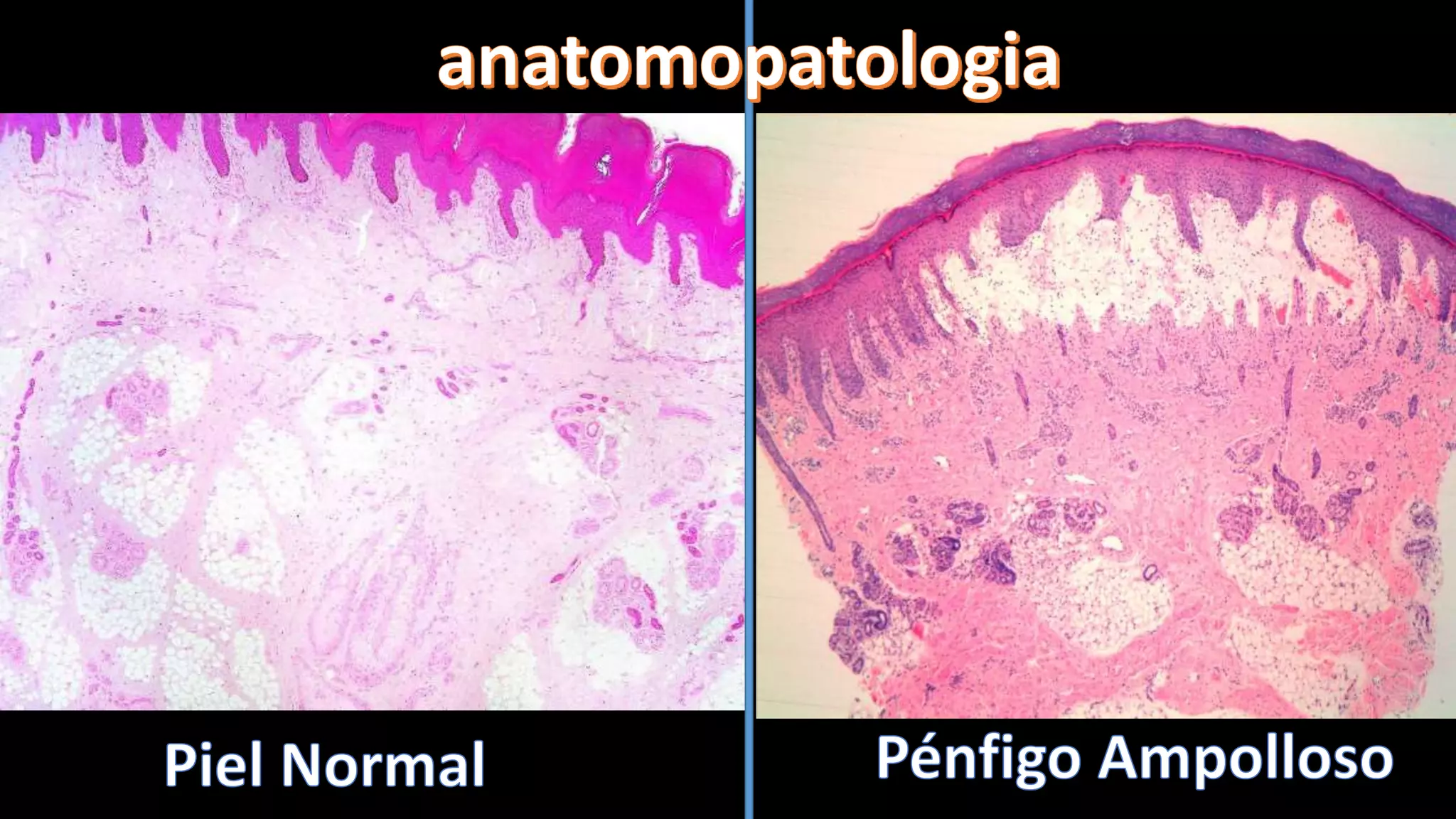 INMUNO. PENFIGO AMPOLLOSO.GESTACIONAL, EPIDERM. ADQUIRIDA INMUNOLOGIA ...