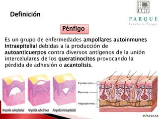 Definición
Es un grupo de enfermedades ampollares autoinmunes
Intraepitelial debidas a la producción de
autoanticuerpos contra diversos antígenos de la unión
intercelulares de los queratinocitos provocando la
pérdida de adhesión o acantolisis.
Pénfigo
 
