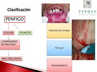 Clasificación
Inducido por drogas
Por Ig A
Paraneoplásico
PENFIGO
VULGAR FOLIACEO
COMPROMISO
DE MUCOSA
MAS FRECUENTE
 