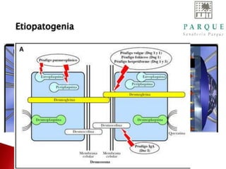 Etiopatogenia
 