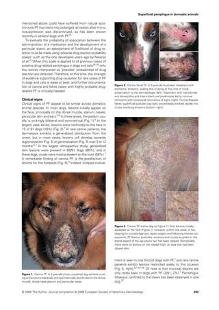 Superﬁcial pemphigus in domestic animals


mentioned above could have suffered from natural auto-
immune PF that went into prolonged remission after immu-
nosuppression was discontinued, as has been shown
recently in several dogs with PF.31
   To evaluate the probability of association between the
administration of a medication and the development of a
particular event, an assessment of likelihood of drug re-
action must be made using ‘adverse drug reaction probability
scales’ such as the one developed years ago by Naranjo
et al.32 When this scale is applied to all previous cases of
putative drug-related pemphigus in dogs and cats25–30 only
low scores interpreted as ‘possible’ probabilities of drug
reaction are obtained. Therefore, at this time, the strength
of evidence supporting drug causation for rare cases of PF
in dogs and cats is weak at best, and further documenta-
                                                                           Figure 2. Canine facial PF. A 3-year-old Australian shepherd with
tion of canine and feline cases with highly probable drug-
                                                                           erythema, erosions, scaling and crusting at the time of initial
related PF is critically needed.                                           presentation to the dermatologist (left). Treatment with niacinamide
                                                                           and tetracycline and intermittent oral prednisone led to minimal
Clinical signs                                                             remission with occasional recurrence of signs (right). During disease
Clinical signs of PF appear to be similar across domestic                  ﬂares, superﬁcial pustules (top right; arrowheads) evolved rapidly into
animal species. In most dogs, lesions initially appear on                  crusts overlying erosions (bottom right).
the face, principally on the dorsal muzzle, planum nasale,
periocular skin and ears.5,6 In these areas, the pattern usu-
ally is strikingly bilateral and symmetrical (Fig. 1).5 In the
largest case series, lesions were restricted to the face in
15 of 91 dogs (16%) (Fig. 2).7 In rare canine patients, the
dermatosis exhibits a generalized distribution from the
onset, but in most cases, lesions will develop towards
regionalization (Fig. 3) or generalization (Fig. 4) over 3 to 12
months.5,7 In the largest retrospective study, generalized
skin lesions were present in 60/91 dogs (66%), and in
these dogs, crusts were most prevalent on the trunk (58%).7
A remarkable ﬁnding of canine PF is the predilection of
lesions for the footpads (Fig. 5).5 Indeed, footpad involve-




                                                                           Figure 3. Canine PF (same dog as Figure 1). Skin lesions initially
                                                                           appeared on the face (Figure 1), however, within one week of hair
                                                                           clipping for cruciate ligament repair surgery and following intense sun
                                                                           exposure, PF lesions (pustules, erosions and crusts) erupted on the
                                                                           lateral aspect of the leg where hair had been clipped. Remarkably,
                                                                           there were no lesions on the medial thigh, an area that had been
                                                                           clipped also.



                                                                           ment is seen in one third of dogs with PF,7 and rare canine
                                                                           patients exhibit lesions restricted solely to this location
                                                                           (Fig. 5; right).6,7,33–36 Of note is that mucosal lesions are
Figure 1. Canine PF. A 2-year-old chow crossbred dog exhibits crust-       only rarely seen in dogs with PF (2/91; 2%).7 Pemphigus
ing and erosions bilaterally and symmetrically distributed on the dorsal   foliaceus conﬁned to the claws has been observed in one
muzzle, dorsal nasal planum and periocular areas.                          dog.37


© 2006 The Author. Journal compilation © 2006 European Society of Veterinary Dermatology.                                                     293
 