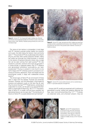 Olivry




Figure 4. Canine PF. This 3-year-old English bulldog was affected
with lesions that progressed rapidly from the face to cover most of the
body surface. Inset: details of rapidly drying pustules and crusts from
the lateral thigh.                                                        Figure 6. Canine PF. Large, grouped and often coalescing superﬁcial
                                                                          pustules exhibit a peripheral erythematous halo. Multiple hair shafts
                                                                          protrude from the roof of the pustule (case material: University of
                                                                          California Davis).

   The nature of skin lesions is comparable in most dogs
with PF: transient pustules evolve rapidly into erosions
and crusts, the latter being the lesions most commonly
seen.5–7 The pustules of PF are usually large and conﬂuent
(Fig. 6), and they often exhibit polycyclic borders. Many
hair shafts can protrude from these pustules, in contrast
to the lesions of bacterial folliculitis where only a single
hair can be seen coming from each pustule.38 On rare
occasions, pustules, erosions and crusts are grouped in
a unique annular, or polycyclic pattern (Fig. 7).5,39 Alopecia
and generalized exfoliative erythroderma are seen
occasionally.5 Pruritus is present in one fourth to one
half of dogs with PF,5 whereas systemic symptoms con-
sisting of anorexia, depression, fever and weight loss are
encountered usually in dogs with widespread erosive
lesions.6
   The clinical signs of feline PF are reminiscent of those
seen in dogs with this disease. Pustules are extremely
transient, however, and the phenotype is dominated by                     Figure 7. Canine PF. Crusts overlie erosions with an erythematous
erosions and yellowish crusts on the face (Fig. 8), ears                  border in a grouped polycyclic arrangement.
(Fig. 9), and on the feet.6,8,9,40 Pedal lesions, consisting of
suppuration or crusts, can be seen on or around the foot-
pads or ungual folds of claws (Fig. 10).6,8,9,35,40 The pheno-              Horses with PF usually are presented with multifocal to
type of feline PF is usually mild and fairly localized, but               generalized crusting, scaling and alopecia affecting the
generalized lesions can be seen also.9 The distribution of                face, neck, trunk and extremities (Fig. 11).6,11,12 Pustules
lesions of feline PF is usually bilateral and symmetrical.9               are observed rarely, and whenever present, they are




                                                                                                   Figure 5. Canine PF. Footpad lesions
                                                                                                   of canine PF vary with their chronicity.
                                                                                                   Acute lesions (left) consist of pustules
                                                                                                   (arrowheads; same dog as in Figure 4),
                                                                                                   erosions and crusts. With time, crusts
                                                                                                   coalesce (middle) and dry to form ﬁssures
                                                                                                   (right).


294                                           © 2006 The Author. Journal compilation © 2006 European Society of Veterinary Dermatology.
 