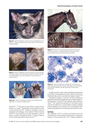 Superﬁcial pemphigus in domestic animals




Figure 8. Feline PF. Alopecia, erosions and crusts developed on the
face of a 1.5-year-old Siamese cat during a ﬂare of PF (courtesy of
Dr Barbara Atlee).




                                                                         Figure 11. Equine PF. A 12-year-old quarterhorse mare exhibits
                                                                         erosions and crusts in a ﬁgurate pattern on the face and neck
                                                                         (case material from the University of California Davis).




Figure 9. Feline PF. Yellowish crusts are present on the convex (left)
or concave aspects of the pinnae of two cats with PF (left: courtesy
of Dr Barbara Atlee; right: case material from the University of
California Davis).




                                                                         Figure 12. Canine PF. Aspiration cytology from the content of a
                                                                         superﬁcial pustule reveals numerous neutrophils, some eosinophils
                                                                         and scattered isolated or grouped acantholytic keratinocytes
                                                                         (Diff–Quick).


                                                                            In goats, pustules, crusts, scales and alopecia predominate
                                                                         on the face, ventral abdomen, limbs, perineum and tail. In
                                                                         female animals, lesions may affect the udder and teats.13 –16
                                                                            Pemphigus foliaceus in animals has been reported in
Figure 10. Feline PF. Crusting can be seen around footpads and
                                                                         association with systemic diseases such as hypothyroidism,42
claws (left) or on pads themselves (right).                              leishmaniasis,43 thymoma44 and systemic lupus erythema-
                                                                         tosus.45 The relationship between PF and these entities
                                                                         may be coincidental, or it could reﬂect a systemic disease
transient.6,11,12 Skin lesions may exhibit a unique annular              process leading to the induction of immunological imbal-
pattern as in dogs.41 Remarkably, ventral oedema is seen                 ances and development of anti-keratinocyte autoimmunity.
in many horses with PF.12 Systemic symptoms, such as
depression and lethargy, were noticed in 50% of horses                   Cytology
with PF in one study6 but a similar observation was not                  The diagnosis of PF in animals commences with the
made in another retrospective study.11 Lesions of equine                 demonstration of acantholytic keratinocytes in impression
PF are occasionally painful and /or pruritic.11,12                       smears of intact pustules (Fig. 12).5–7 Indeed, isolated to


© 2006 The Author. Journal compilation © 2006 European Society of Veterinary Dermatology.                                                 295
 