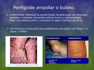 Penfigoide | PPTX