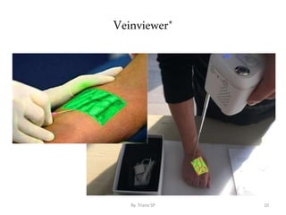 Veinviewer*
By. Triana SP 10
 