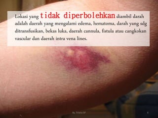 Lokasi yang tidak diperbolehkan diambil darah
adalah daerah yang mengalami edema, hematoma, darah yang sdg
ditransfusikan, bekas luka, daerah cannula, fistula atau cangkokan
vascular dan daerah intra vena lines.
6
By. Triana SP
 