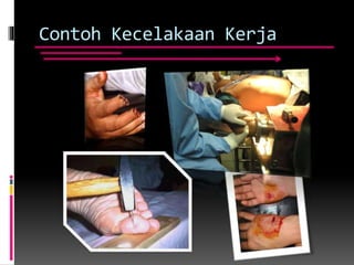 Contoh Kecelakaan Kerja
 