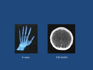 X-rays Cat-scans
 