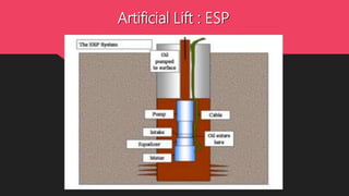 Artificial Lift : ESP
 