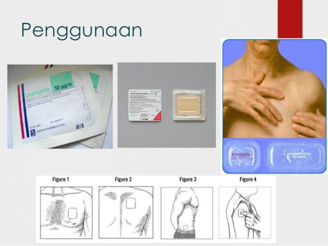 Pengelolaan perbekalan farmasi,narkotika dan pengelolaan 