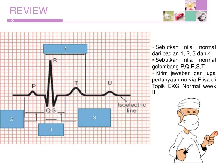 Unduh 91 Gambar Gelombang Ekg Normal  