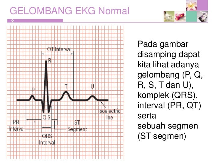 Pengenalan ekg dasar Pengenalan ekg dasar