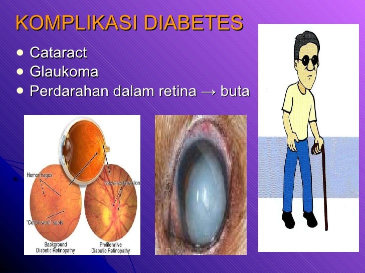 Ubat Diabetes - Contoh Kri