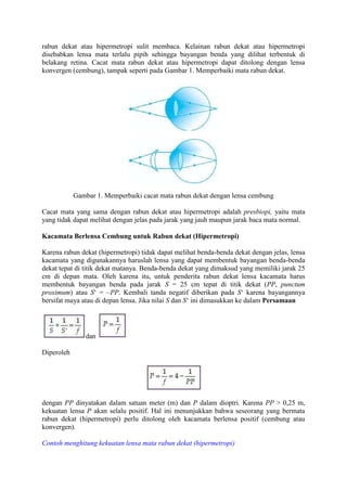 rabun dekat atau hipermetropi sulit membaca. Kelainan rabun dekat atau hipermetropi
disebabkan lensa mata terlalu pipih sehingga bayangan benda yang dilihat terbentuk di
belakang retina. Cacat mata rabun dekat atau hipermetropi dapat ditolong dengan lensa
konvergen (cembung), tampak seperti pada Gambar 1. Memperbaiki mata rabun dekat.




            Gambar 1. Memperbaiki cacat mata rabun dekat dengan lensa cembung

Cacat mata yang sama dengan rabun dekat atau hipermetropi adalah presbiopi, yaitu mata
yang tidak dapat melihat dengan jelas pada jarak yang jauh maupun jarak baca mata normal.

Kacamata Berlensa Cembung untuk Rabun dekat (Hipermetropi)

Karena rabun dekat (hipermetropi) tidak dapat melihat benda-benda dekat dengan jelas, lensa
kacamata yang digunakannya haruslah lensa yang dapat membentuk bayangan benda-benda
dekat tepat di titik dekat matanya. Benda-benda dekat yang dimaksud yang memiliki jarak 25
cm di depan mata. Oleh karena itu, untuk penderita rabun dekat lensa kacamata harus
membentuk bayangan benda pada jarak S = 25 cm tepat di titik dekat (PP, punctum
proximum) atau S„ = –PP. Kembali tanda negatif diberikan pada S„ karena bayangannya
bersifat maya atau di depan lensa. Jika nilai S dan S„ ini dimasukkan ke dalam Persamaan




                dan

Diperoleh




dengan PP dinyatakan dalam satuan meter (m) dan P dalam dioptri. Karena PP > 0,25 m,
kekuatan lensa P akan selalu positif. Hal ini menunjukkan bahwa seseorang yang bermata
rabun dekat (hipermetropi) perlu ditolong oleh kacamata berlensa positif (cembung atau
konvergen).

Contoh menghitung kekuatan lensa mata rabun dekat (hipermetropi)
 