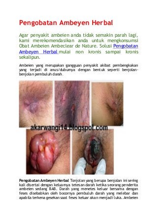 Pengobatan Ambeyen Herbal 
Agar penyakit ambeien anda tidak semakin parah lagi, 
kami merekomendasikan anda untuk mengkonsumsi 
Obat Ambeien Ambeclear de Nature. Solusi Pengobatan 
Ambeyen Herbal mulai non kronis sampai kronis 
sekalipun. 
Ambeien yang merupakan gangguan penyakit akibat pembengkakan 
yang terjadi di anus/duburnya dengan bentuk seperti benjolan-benjolan 
pembuluh darah. 
Pengobatan Ambeyen Herbal Tonjolan yang berupa benjolan ini sering 
kali disertai dengan keluarnya tetesan darah ketika seorang penderita 
ambeien sedang BAB. Darah yang menetes keluar bersama dengan 
feses disebabkan oleh bocornya pembuluh darah yang melebar dan 
apabila terkena gesekan saat feses keluar akan menjadi luka. Ambeien 
 