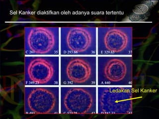 Sel Kanker diaktifkan oleh adanya suara tertentu
Ledakan Sel Kanker
 