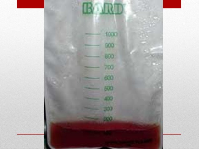 PENGUKURAN CECAIR - INTAKE OUTPUT PENGUKURAN CECAIR - INTAKE OUTPUT