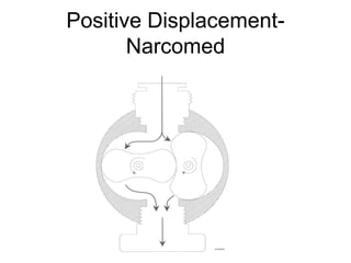 Positive Displacement-
Narcomed
 