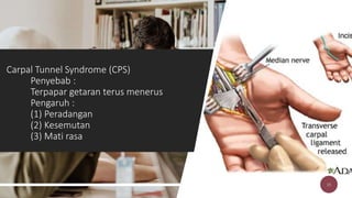 Carpal Tunnel Syndrome (CPS)
Penyebab :
Terpapar getaran terus menerus
Pengaruh :
(1) Peradangan
(2) Kesemutan
(3) Mati rasa
15
 