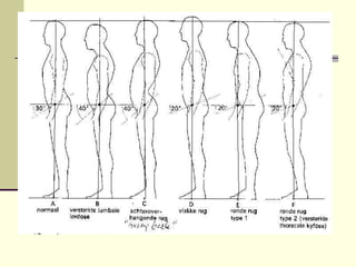 Pengukuran_Postur.ppt
