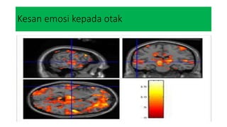 Kesan emosi kepada otak
 