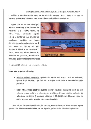 INSTRUÇÃO TÉCNICA PARA A PRESCRIÇÃO E A UTILIZAÇÃO DE PENICILINAS 29

>            ')           !                 !                     '                    !       !                                                ! *              !                      !
 !           !' +              !            !                                          +           .!        ; ; " ! !                                %.!Q


C        R            O OC             , ! ! !                    !'-              !
: !' %.!              !        !' <                           !' %.!
              '                         >O OOO 2 $                    , "
              *                             ')            !                   ';
>DNB / !                       '                                          !        !
         # %!                          #*                             '!
              !       !                5                  7                        C
                      !                     R %.!                             ! !
        !'-       !           ! !                                     '
>O OOO 2 $                ,        .! !                               '            !
    !             !                '        %.!                               ;!
         '            +                " .!


D                         CO                    !                 !                    L'


    %                     %* % "                        ; 3       7


                                                *             !                "!_ +                ! .! ;! "                       '       %.! ! '!             '           '        %.!
                      +            ! L !                          '                         ! !           +       '+            !       !        '       .!                  !          '!
                                        Q


                                                    *         !       !        "!_ +                    ! ! !               ' " %.!                          ' : !           !
                                            !                 ! ! !<                                     !                  !                    !'!         '           '       %.!
                      !' %.!                                  '                !                              '        >_ >O OOO 2 $ !                       5           !        !     !
                      +        !                    !         !' : !' %.! !                         ! !           !'-       !<


                      '                 !                                 *            ! !          !        "                      ;       !                        !   *       !
+                 !                !                                                       !                 "          !               !                    !               !
 