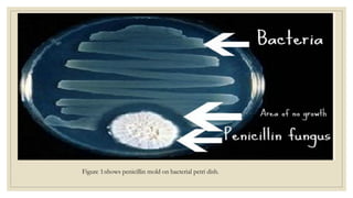 Figure 1:shows penicillin mold on bacterial petri dish.
 