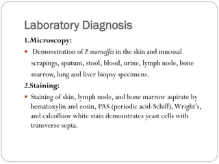 Laboratory Diagnosis
1.Microscopy:
 Demonstration of P.marneffei in the skin and mucosal
scrapings, sputum, stool, blood, urine, lymph node, bone
marrow, lung and liver biopsy specimens.
2.Staining:
 Staining of skin, lymph node, and bone marrow aspirate by
hematoxylin and eosin, PAS (periodic acid-Schiff),Wright’s,
and calcofluor white stain demonstrates yeast cells with
transverse septa.
 