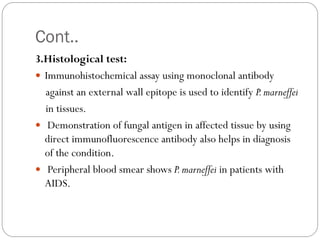Cont..
3.Histological test:
 Immunohistochemical assay using monoclonal antibody
against an external wall epitope is used to identify P.marneffei
in tissues.
 Demonstration of fungal antigen in affected tissue by using
direct immunofluorescence antibody also helps in diagnosis
of the condition.
 Peripheral blood smear shows P.marneffei in patients with
AIDS.
 