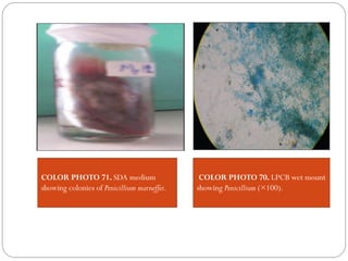 COLOR PHOTO 71. SDA medium
showing colonies of Penicillium marneffei.
COLOR PHOTO 70. LPCB wet mount
showing Penicillium (×100).
 