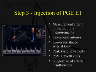 Penile Color Doppler Evaluation for Erectile Dysfunction | PPT