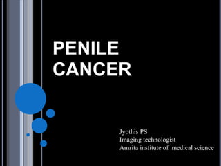PENILE
CANCER


     Jyothis PS
     Imaging technologist
     Amrita institute of medical science
 