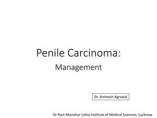 Penile Carcinoma:
Management
Dr. Animesh Agrawal
Dr Ram Manohar Lohia Institute of Medical Sciences, Lucknow
 