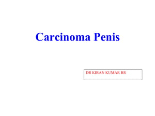 Carcinoma Penis
DR KIRAN KUMAR BR
 